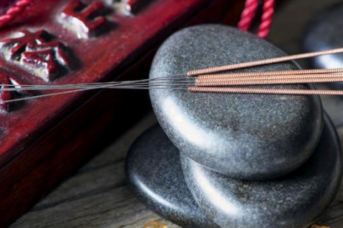 Agujas de acupuntura actuales